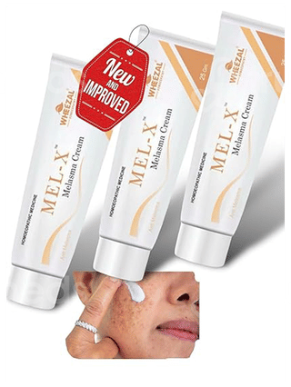 Wheezal Mel X Melasma Cream 25Gm